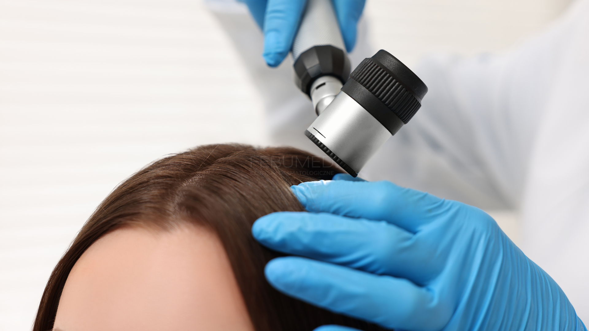 Podrażniona skóra głowy - przyczyny, choroby, diagnostyka i konsultacja u dermatologa