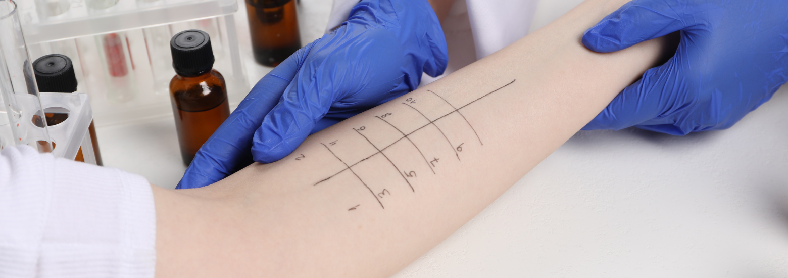 Testy alergiczne zalecane w atopowym zapaleniu skóry (AZS)