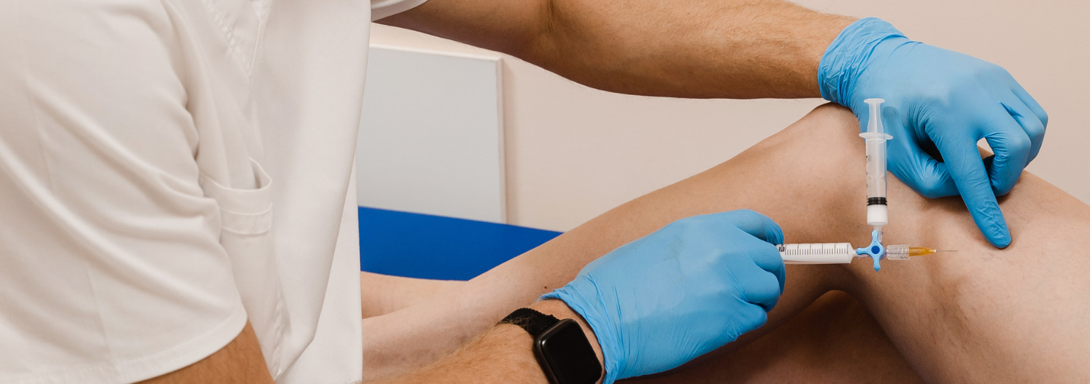 Skleroterapia - zabieg estetyczny wykonywany w celu redukcji pajączków.