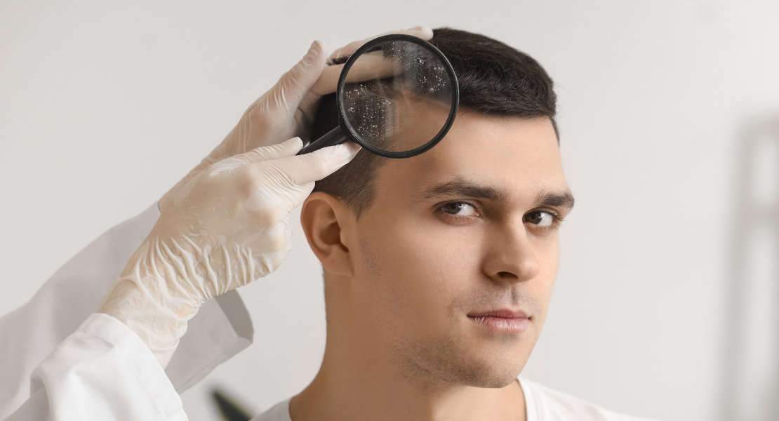 Alergia skóry głowy - objawy, przyczyny i skuteczne metody leczenia