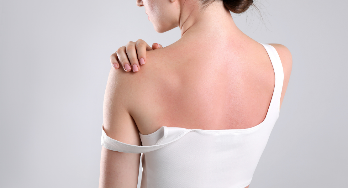 Swędzenie pleców bez wysypki - czy to alergia?