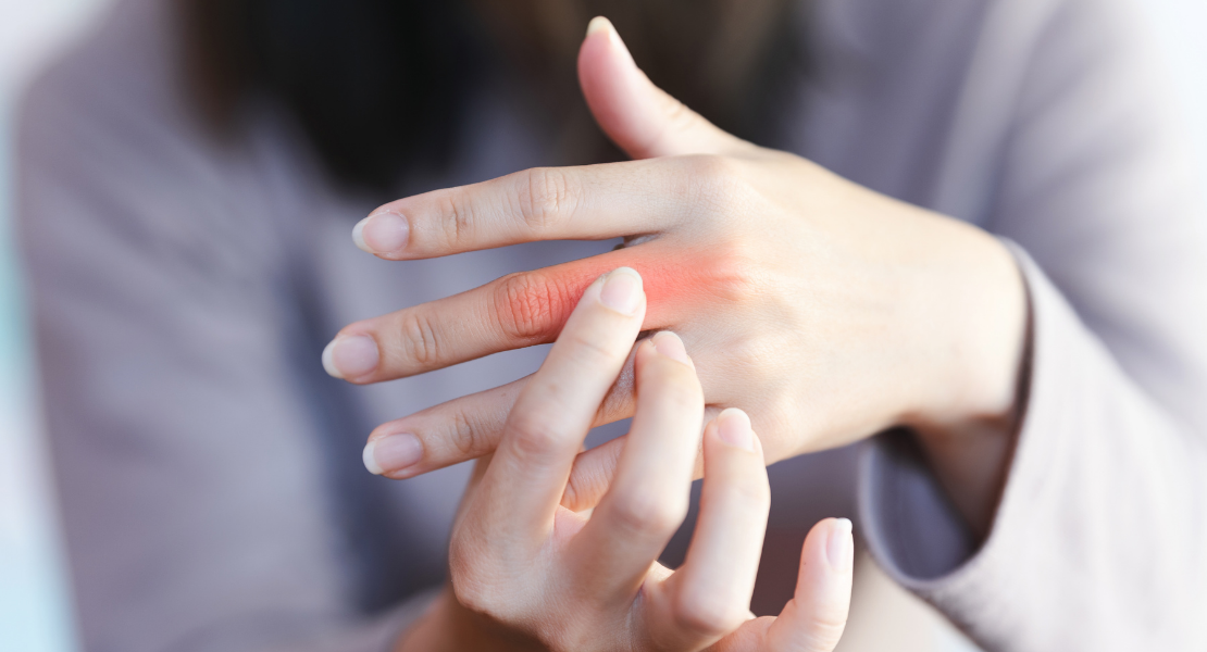 Kobieta trzymająca się za bolący, zaczerwieniony staw palca wskazującego u nasady dłoni - objawy palca trzaskającego.