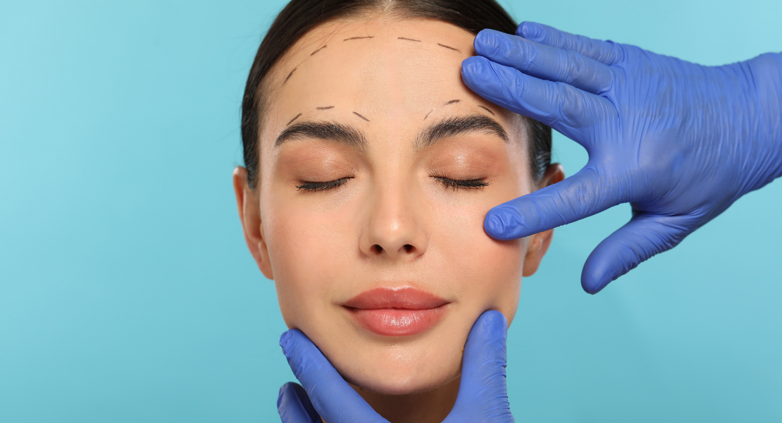 Zbliżenie na twarz kobiety z naniesionymi przerywanymi liniami do operacji plastycznej, dotykaną przez osobę w niebieskiej rękawiczce medycznej.